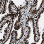 Immunohistochemical staining of human fallopian tube shows strong nuclear positivity in glandular cells.