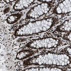 Immunohistochemical staining of human rectum shows strong nuclear positivity in glandular cells.
