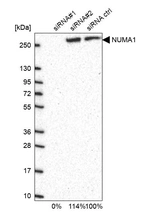 Western blot analysis in U2OS cells transfected with control siRNA, target specific siRNA probe #1 and #2, using Anti-NUMA1 antibody. Remaining relative intensity is presented.