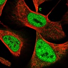 Immunofluorescent staining of human cell line U-2 OS shows localization to nucleoplasm.