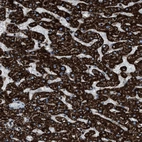 Immunohistochemical staining of human liver shows strong positivity in cytoplasm granular in hepatocytes.