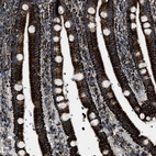 Immunohistochemical staining of human duodenum shows strong positivity in cytoplasm granular in glandular cells.