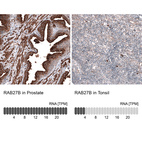 Anti-RAB27B Antibody