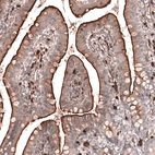 Immunohistochemical staining of human small intestine shows strong positivity in apical membranes in glandular cells.