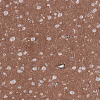 Anti-RAB27B Antibody