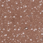 Immunohistochemical staining of human cerebral cortex shows moderate positivity in neuropil.