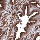 Immunohistochemical staining of human prostate shows strong apical membrane and cytoplasmic positivity in glandular cells.