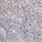 Immunohistochemical staining of human tonsil shows mainly very weak positivity in lymphoid cells as expected.
