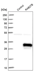Western blot analysis in control (vector only transfected HEK293T lysate) and RAB27B over-expression lysate (Co-expressed with a C-terminal myc-DDK tag (~3.1 kDa) in mammalian HEK293T cells, LY418170).