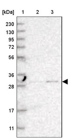 Lane 1: Marker [kDa] 230, 130, 95, 72, 56, 36, 28, 17, 11_br/_Lane 2: Human cell line RT-4_br/_Lane 3: Human cell line U-251MG sp