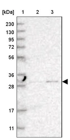 Lane 1: Marker [kDa] 230, 130, 95, 72, 56, 36, 28, 17, 11_br/_Lane 2: Human cell line RT-4_br/_Lane 3: Human cell line U-251MG sp