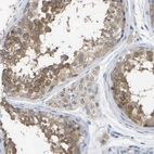 Anti-WIPI2 Antibody