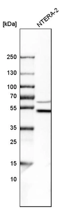 Western blot analysis in human cell line NTERA-2.