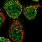Immunofluorescent staining of human cell line A-431 shows localization to nucleoplasm & cytosol.