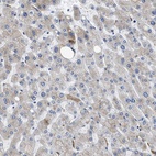 Anti-GC Antibody