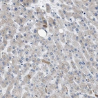 Anti-GC Antibody