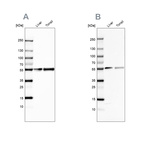 Western blot analysis using Anti-GC antibody HPA019855 (A) shows similar pattern to independent antibody HPA001526 (B).
