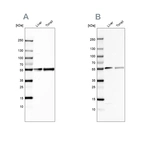 Western blot analysis using Anti-GC antibody HPA019855 (A) shows similar pattern to independent antibody HPA001526 (B).