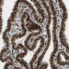 Immunohistochemical staining of human fallopian tube shows strong nuclear positivity in glandular cells.