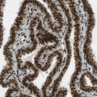 Immunohistochemical staining of human fallopian tube shows strong nuclear positivity in glandular cells.