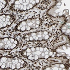 Immunohistochemical staining of human rectum shows strong nuclear positivity in glandular cells.