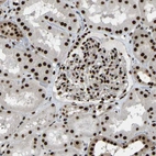 Immunohistochemical staining of human kidney shows strong nuclear positivity in cells in tubules and cells in glomeruli.