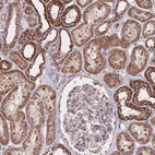 Anti-NUDT21 Antibody