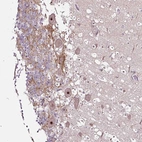 Anti-NOM1 Antibody