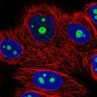Immunofluorescent staining of human cell line MCF7 shows localization to nucleoli.