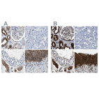 Anti-GSTP1 Antibody