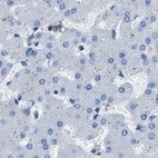 Immunohistochemical staining of human liver using Anti-GSTP1 antibody HPA019869.