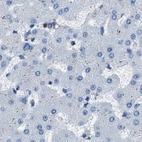 Immunohistochemical staining of human liver using Anti-GSTP1 antibody HPA019869.