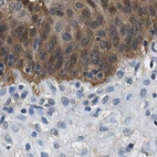 Immunohistochemical staining of human urinary bladder using Anti-GSTP1 antibody HPA019869.