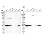 Western blot analysis using Anti-GSTP1 antibody HPA019869 (A) shows similar pattern to independent antibody HPA019779 (B).