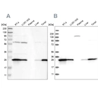 Western blot analysis using Anti-GSTP1 antibody HPA019869 (A) shows similar pattern to independent antibody HPA019779 (B).