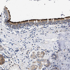 Anti-RINT1 Antibody