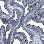 Immunohistochemical staining of human Fallopian tube shows strong positivity in apical membrane in glandular cells.
