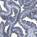 Immunohistochemical staining of human Fallopian tube shows strong positivity in apical membrane in glandular cells.