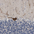 Immunohistochemical staining of human cerebellum shows strong cytoplasmic positivity in Purkinje cells.