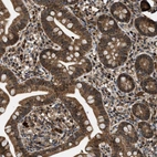 Anti-PPA1 Antibody