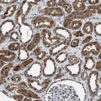 Immunohistochemical staining of human kidney shows strong cytoplasmic positivity in cells in tubules.