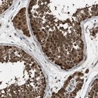 Immunohistochemical staining of human testis shows strong cytoplasmic positivity in cells in seminiferous ducts.
