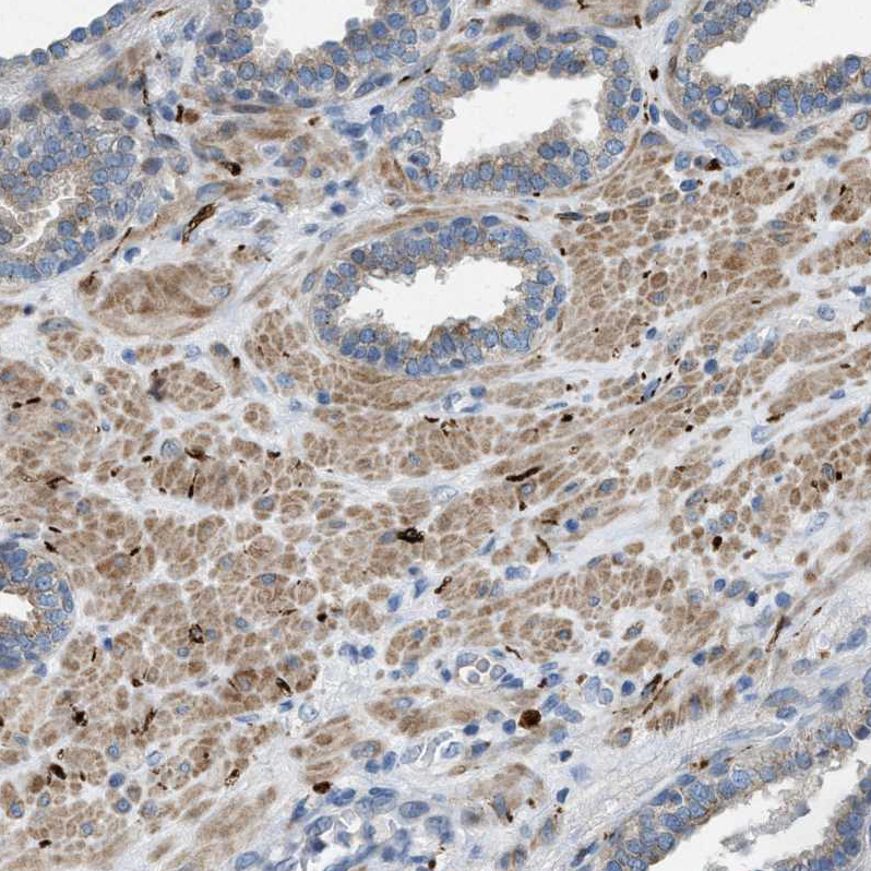 Anti-URGCP Antibody