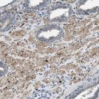 Anti-URGCP Antibody