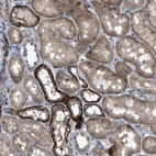 Immunohistochemical staining of human kidney shows moderate to strong cytoplasmic positivity in cells in tubules.