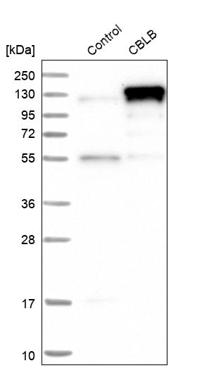 Anti-CBLB Antibody