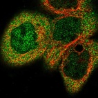 Immunofluorescent staining of human cell line A-431 shows localization to nucleoplasm & cytosol.