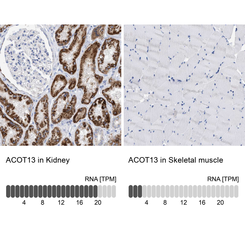 Anti-ACOT13 Antibody