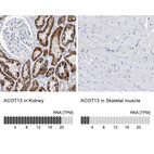 Anti-ACOT13 Antibody