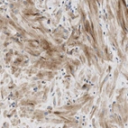 Anti-IL17RC Antibody